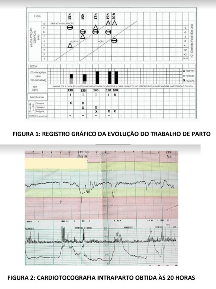 Imagem da questão de Atendimento ao Trabalho de Parto