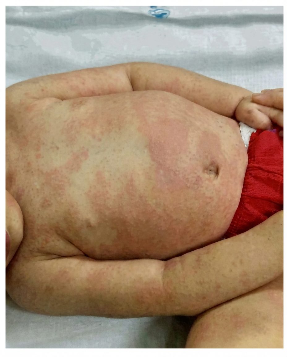 Imagem da questão de Vasculites
