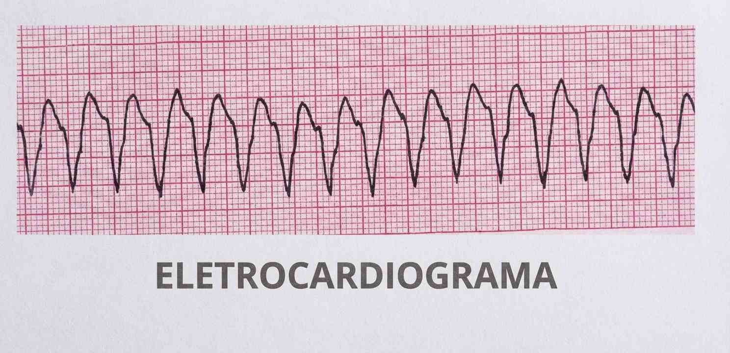 Imagem da questão de Choque
