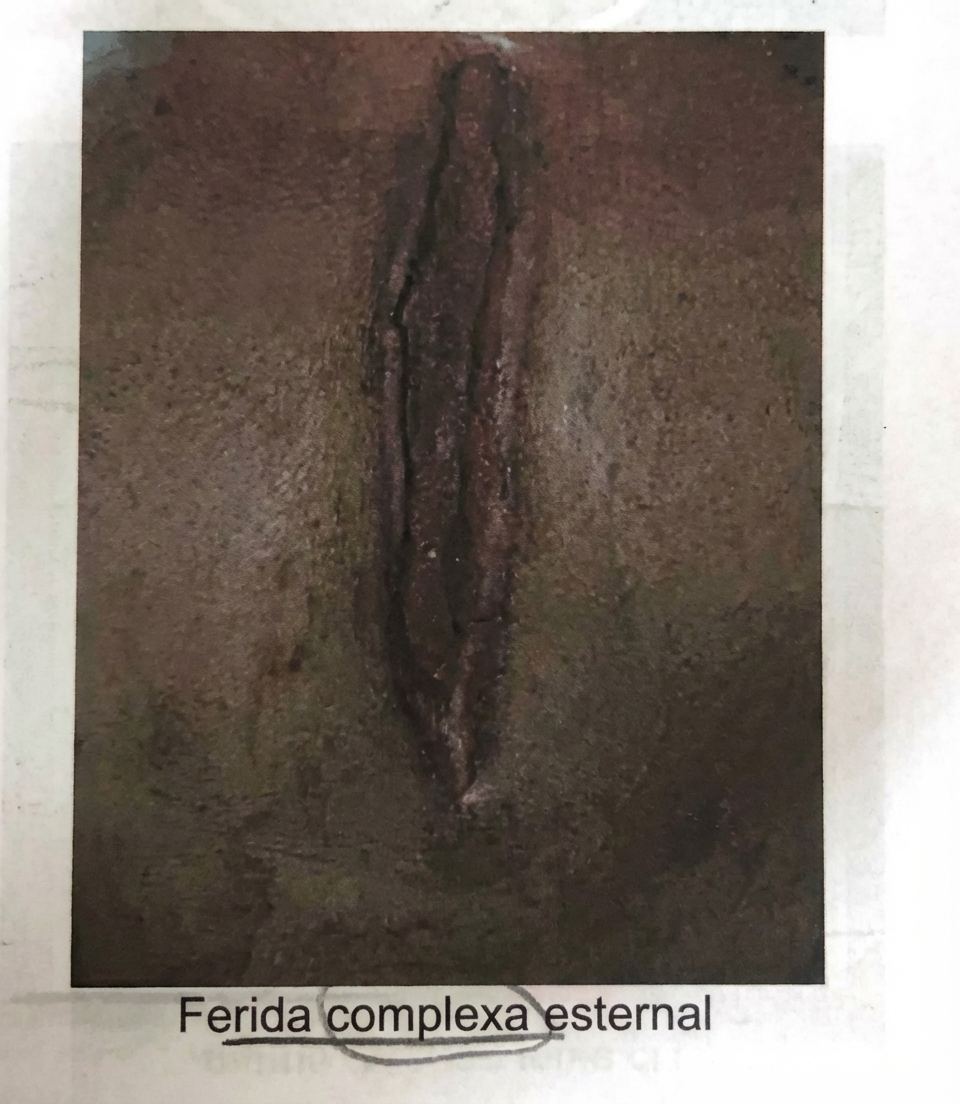 Imagem da questão de Técnicas de Reconstrução