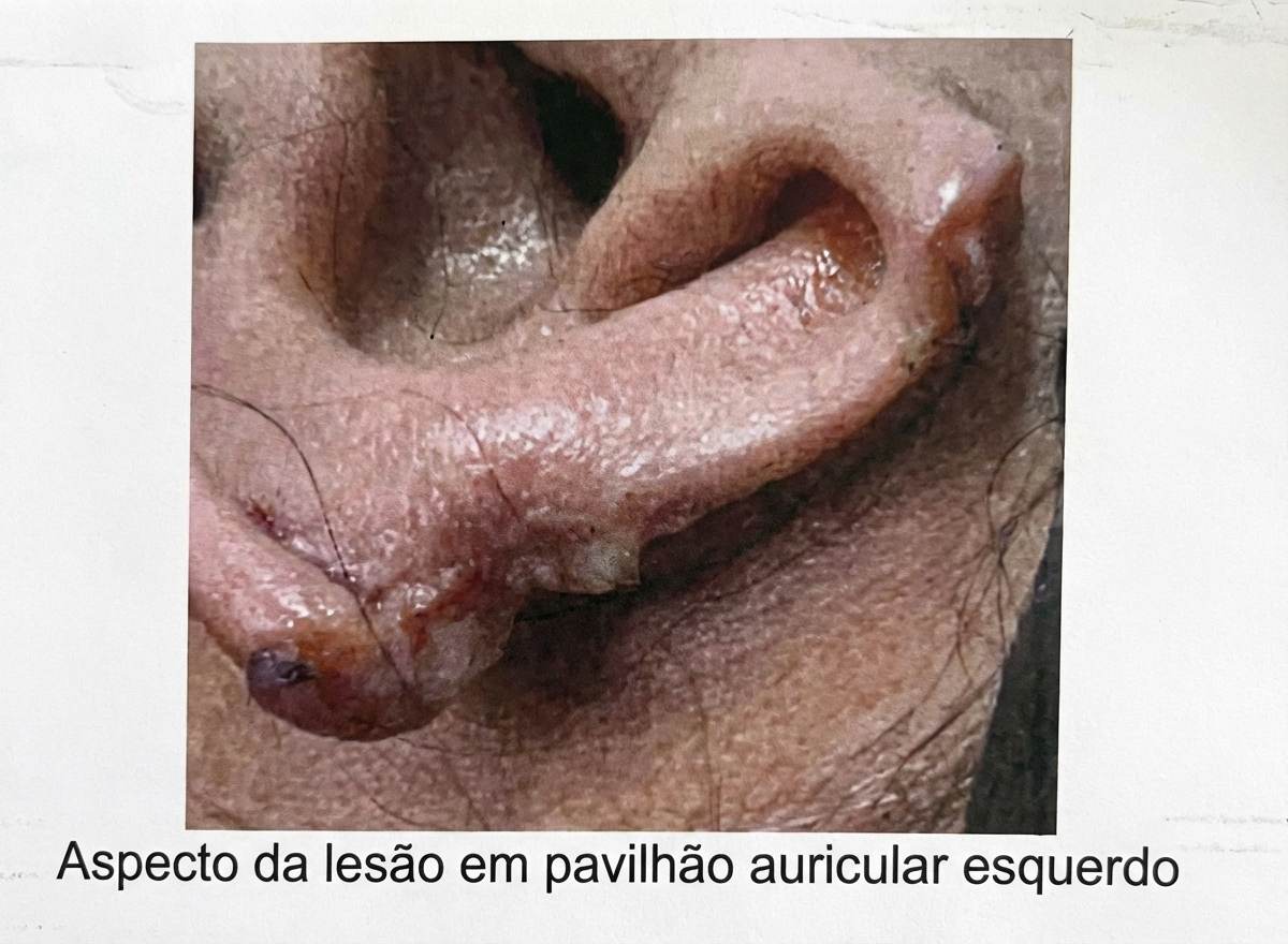 Imagem da questão de Trauma Facial