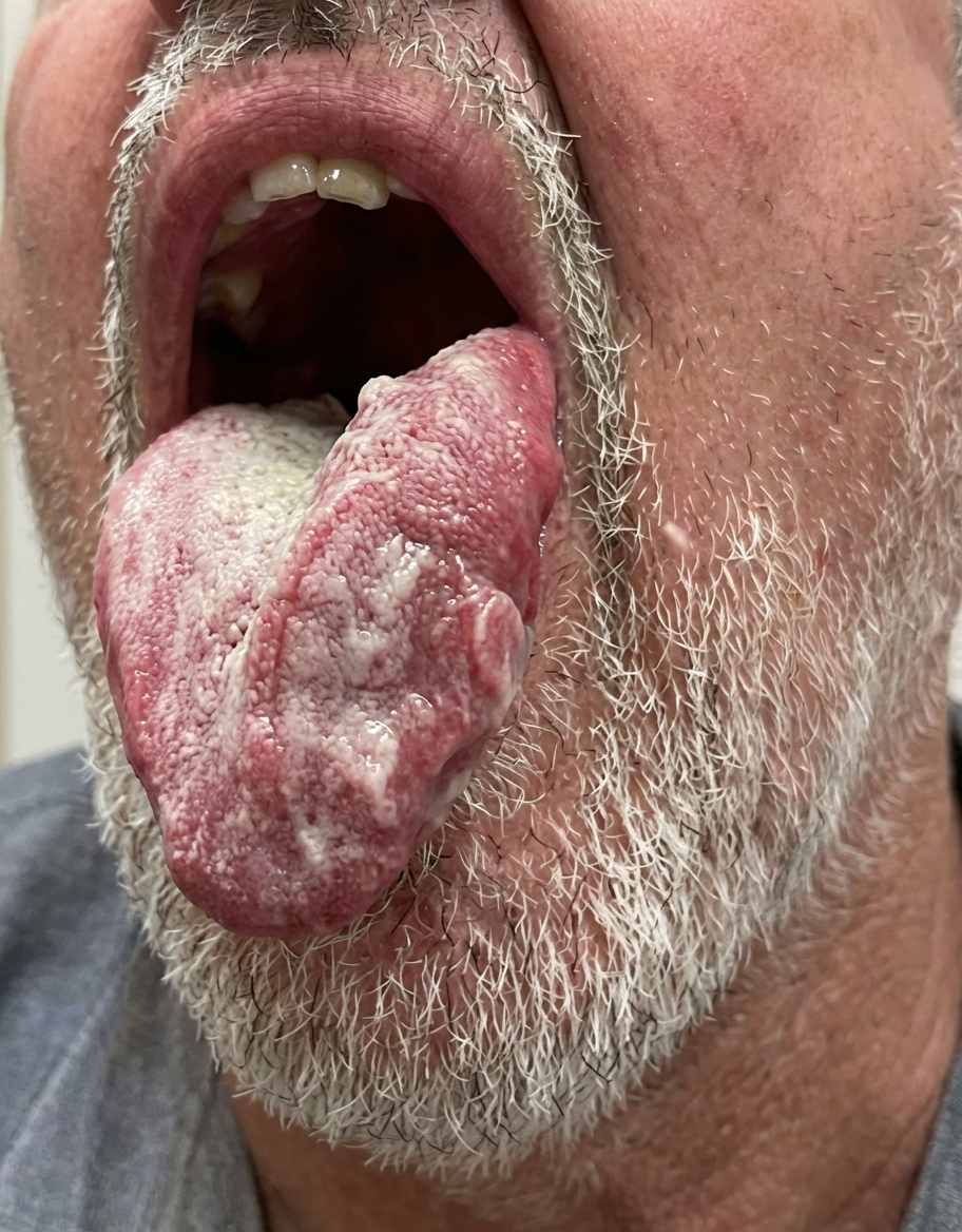 Imagem da questão de Zoonoses