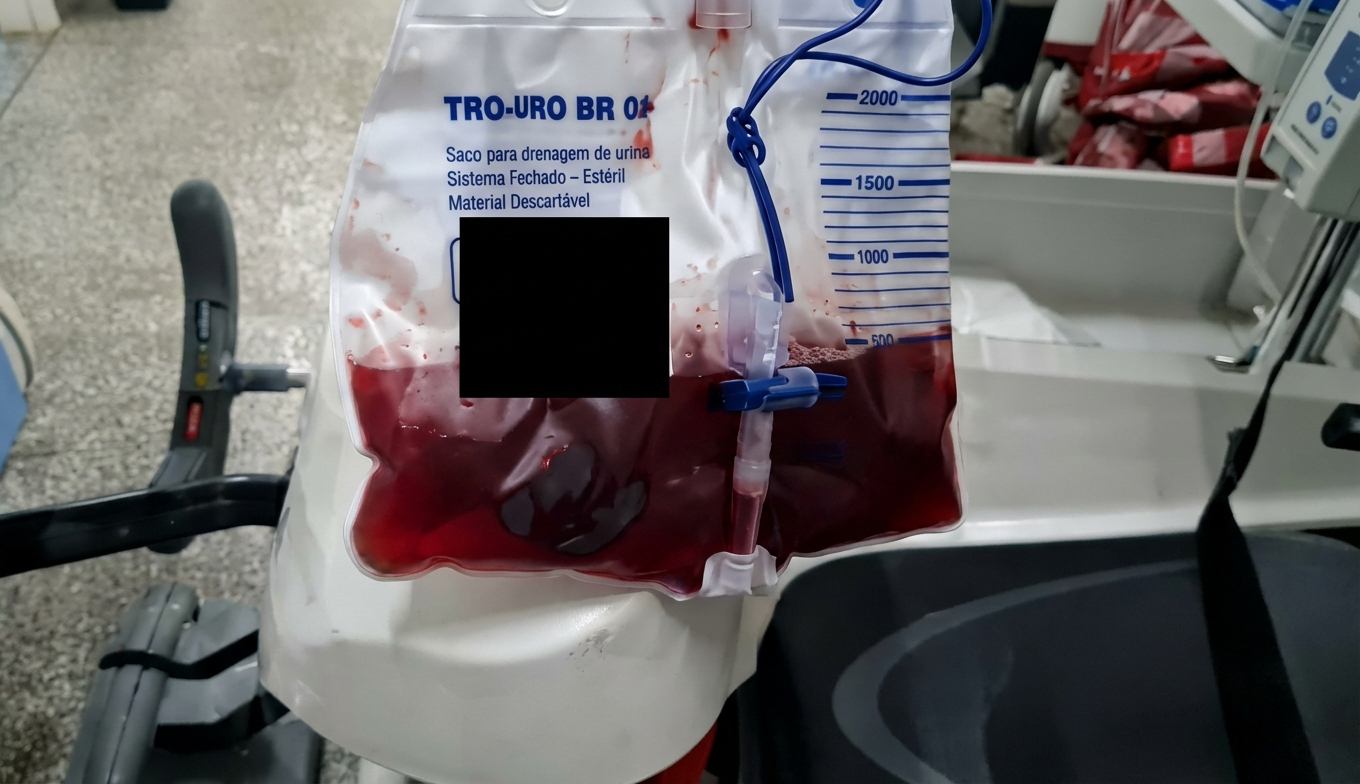 Imagem da questão de Acidentes Biológicos