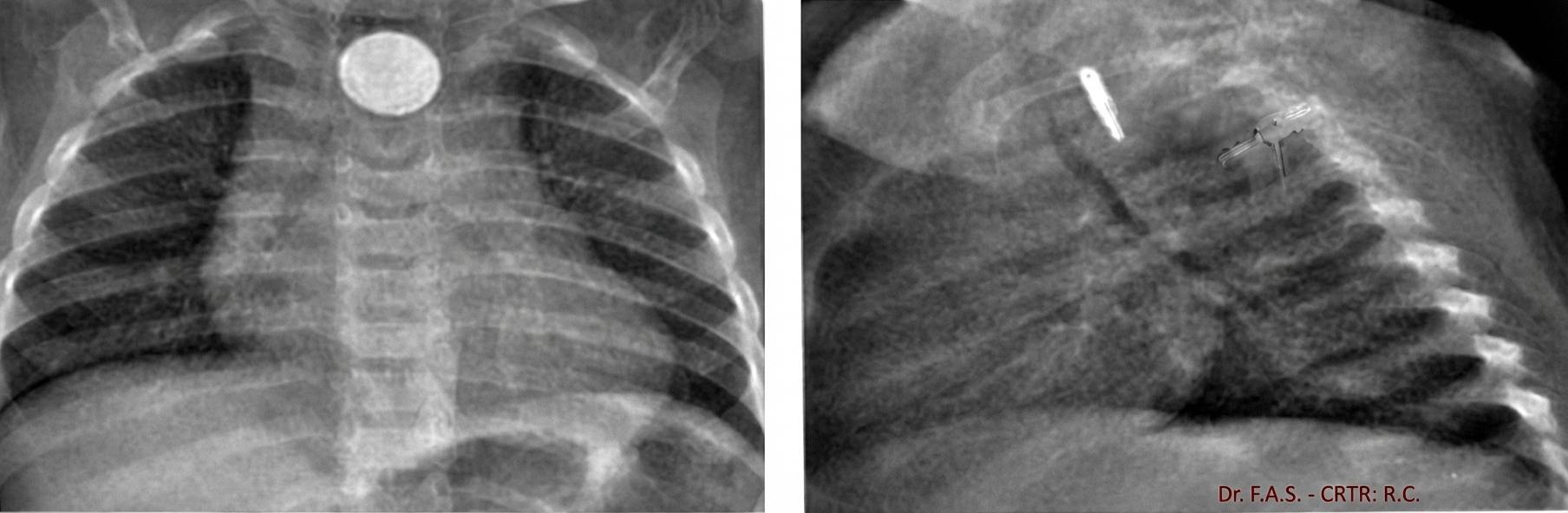 Imagem da questão de Emergências Gastrointestinais