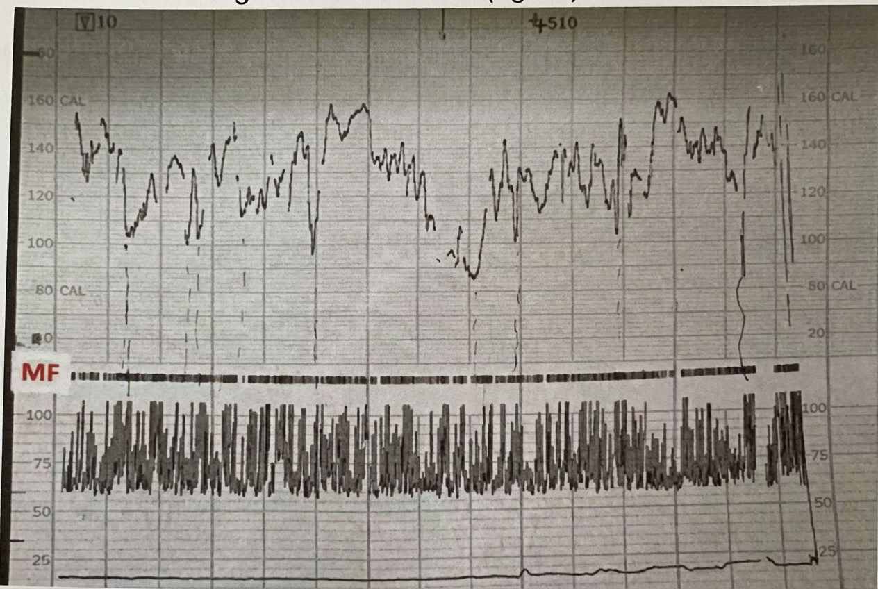 Imagem da questão de Monitorização Fetal