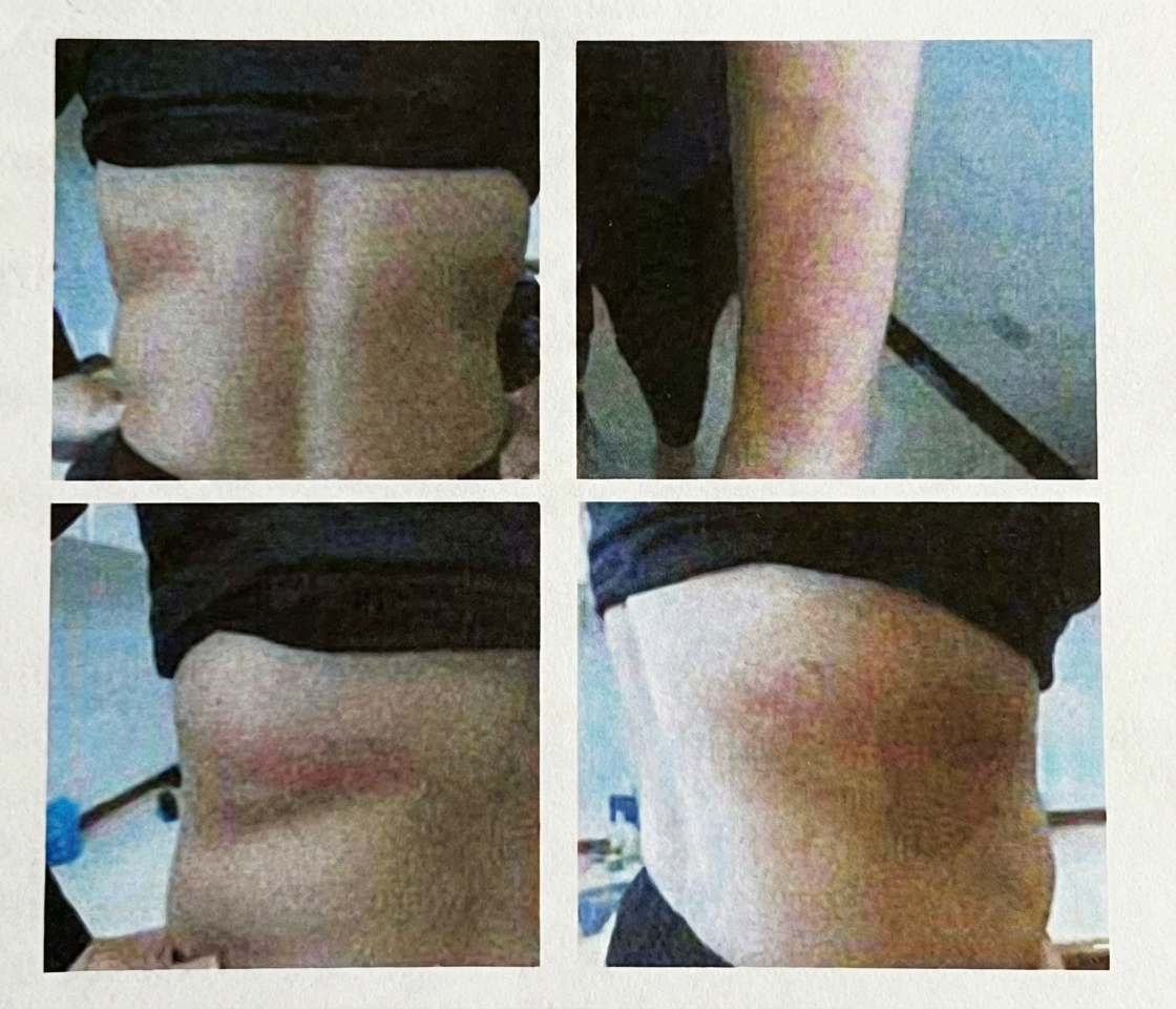 Imagem da questão de Dermatoses Inflamatórias