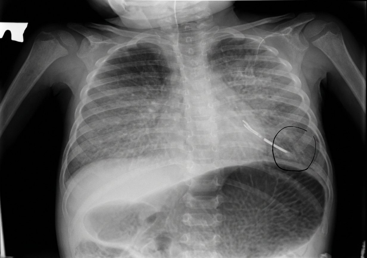 Imagem da questão de Suporte Nutricional