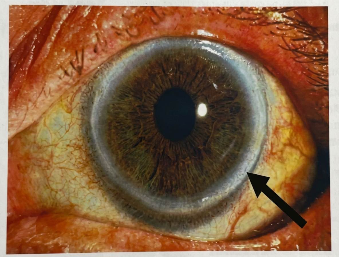 Imagem da questão de Superfície Ocular