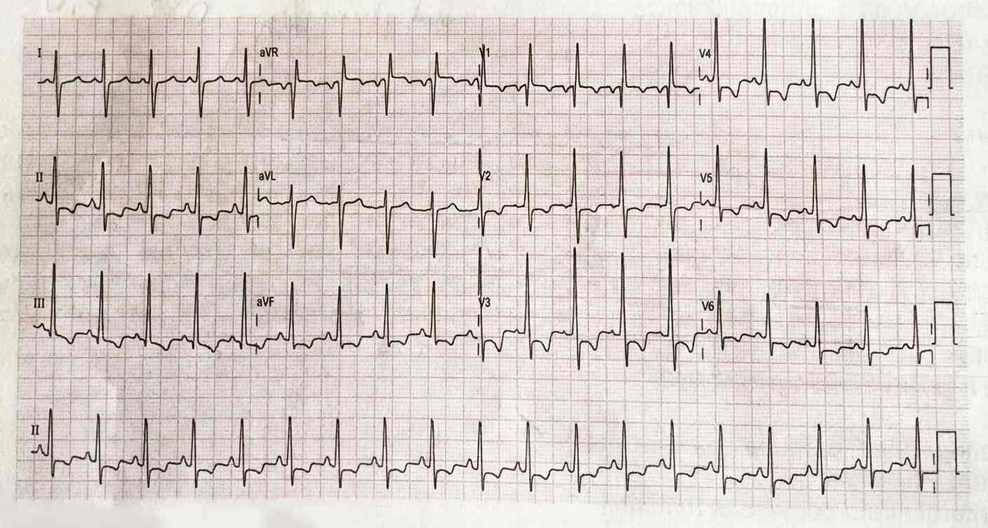 Imagem da questão de Distúrbios Vasculares Pulmonares