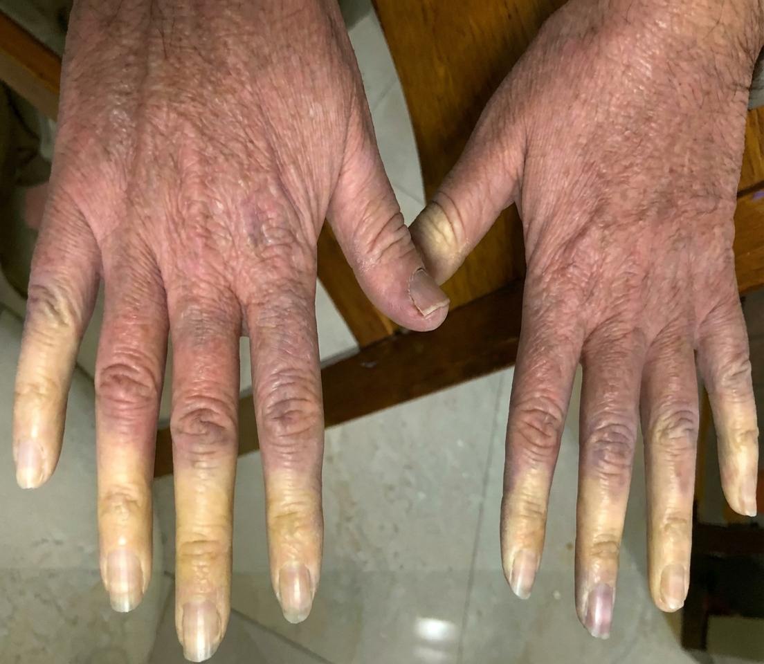 Imagem da questão de Doenças Autoimunes Sistêmicas