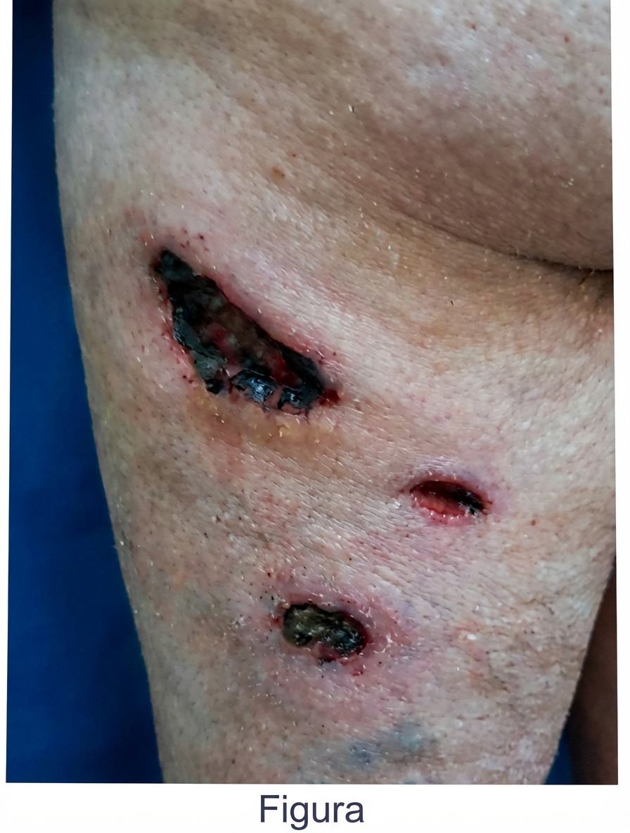 Imagem da questão de Zoonoses