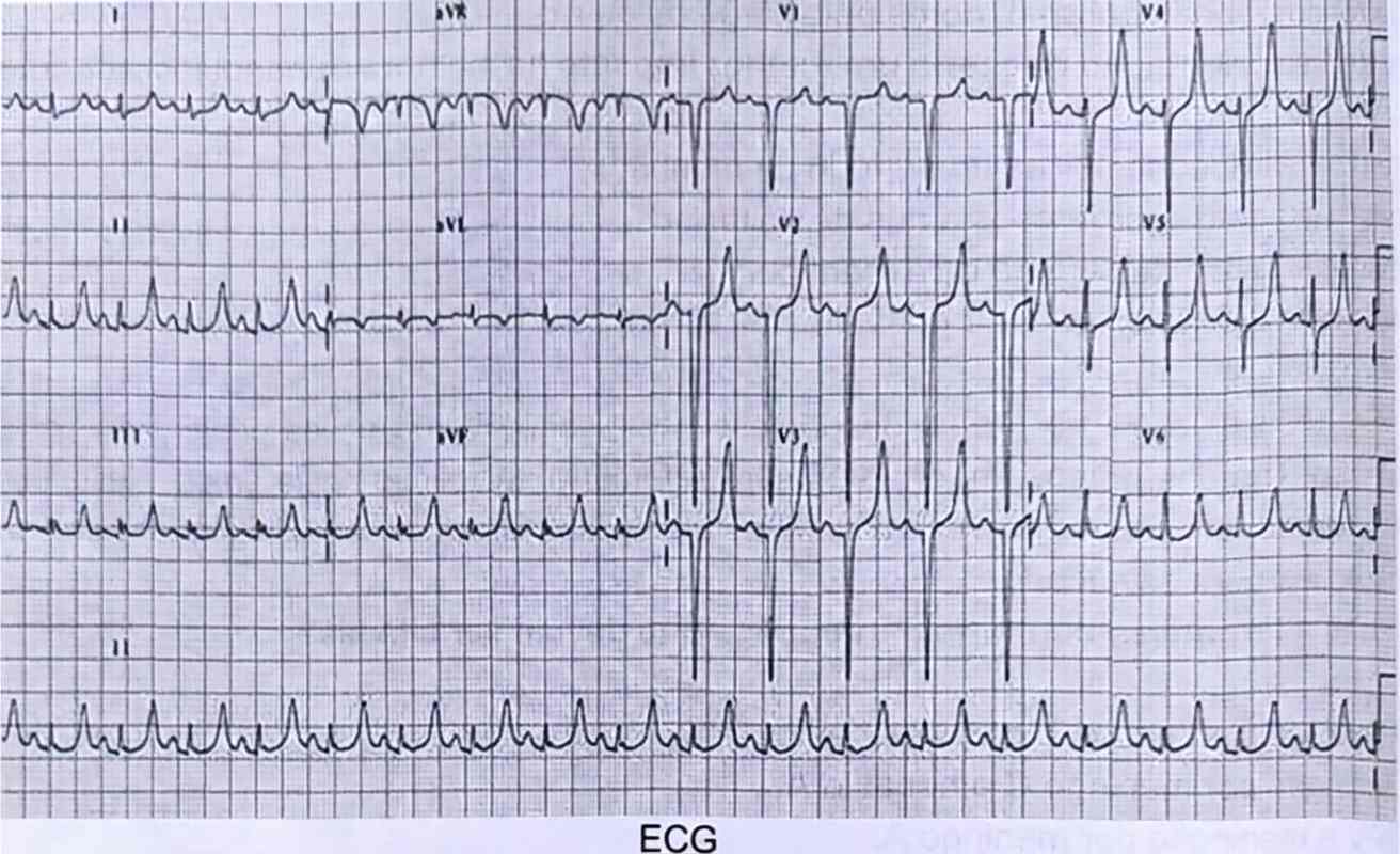 Imagem da questão de Distúrbios Hidroeletrolíticos