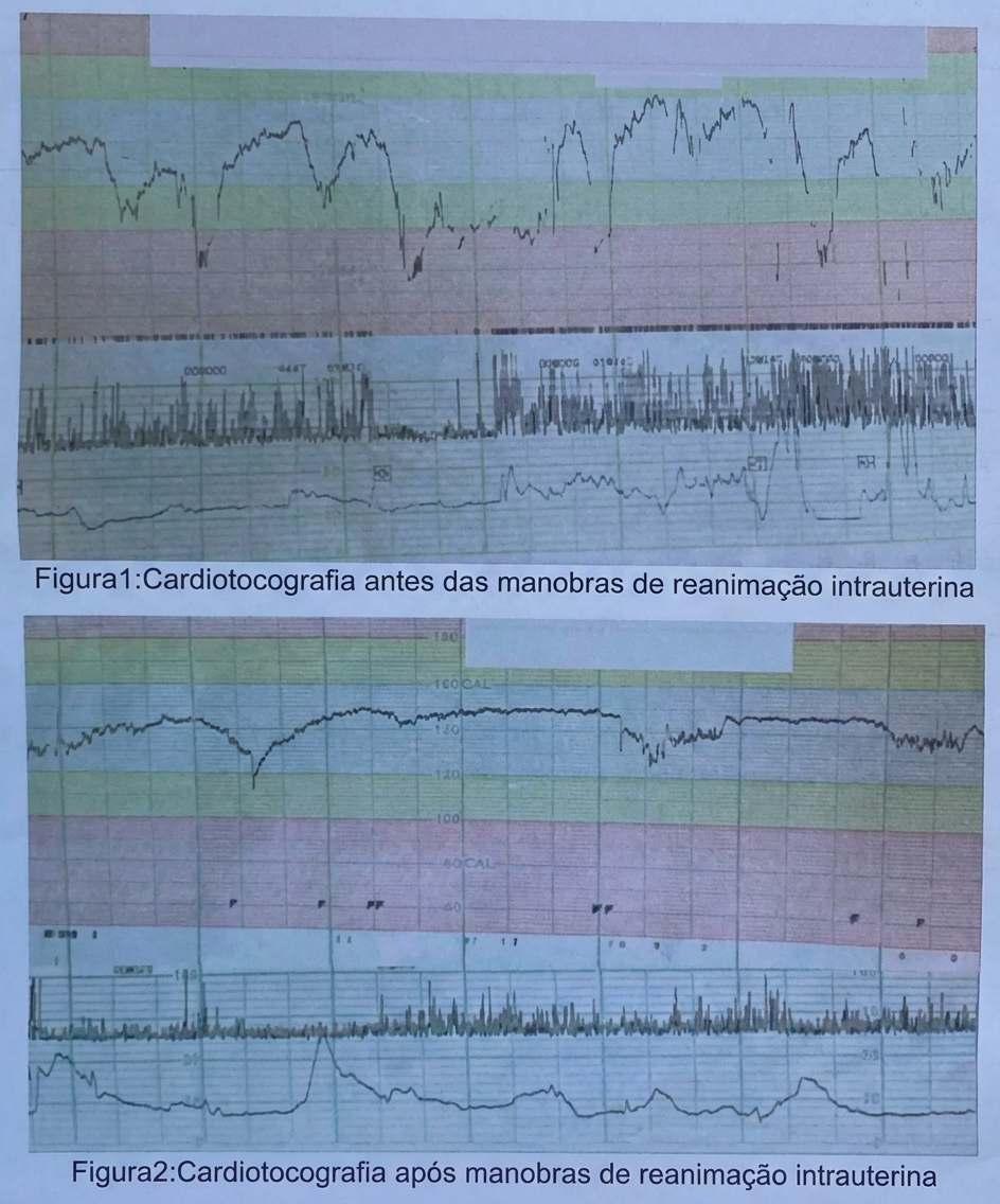 Imagem da questão de Monitorização Fetal