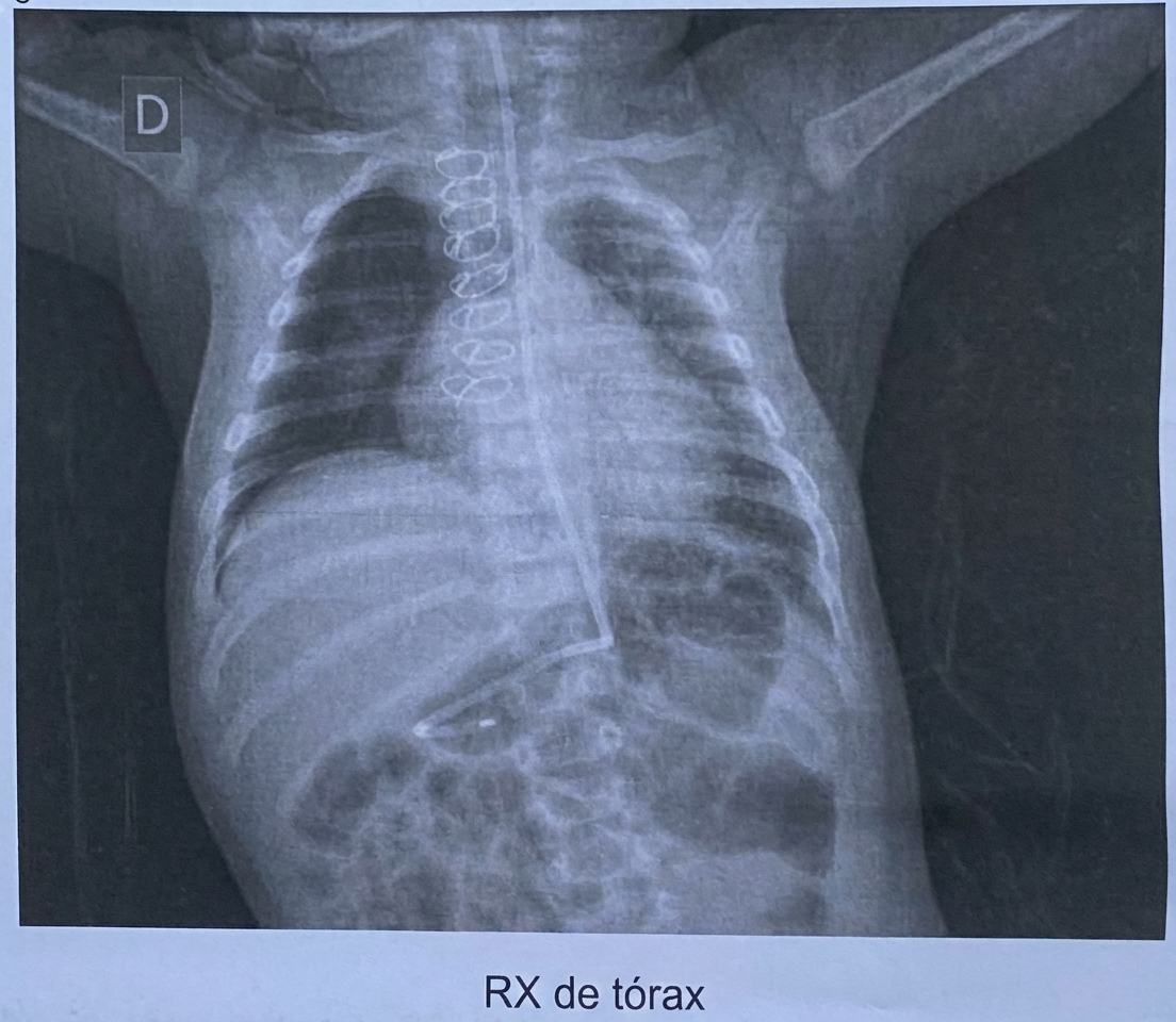 Imagem da questão de Pós-Operatório