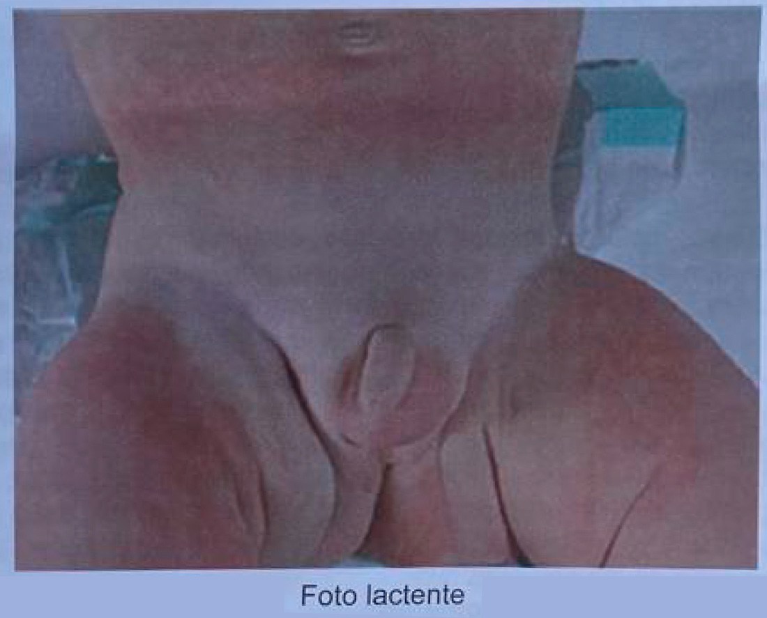Imagem da questão de Dermatoses Inflamatórias