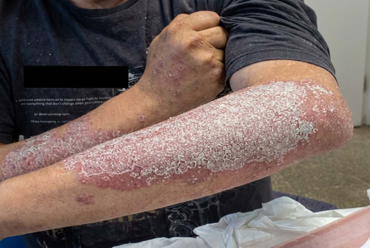 Imagem da questão de Espondiloartrites
