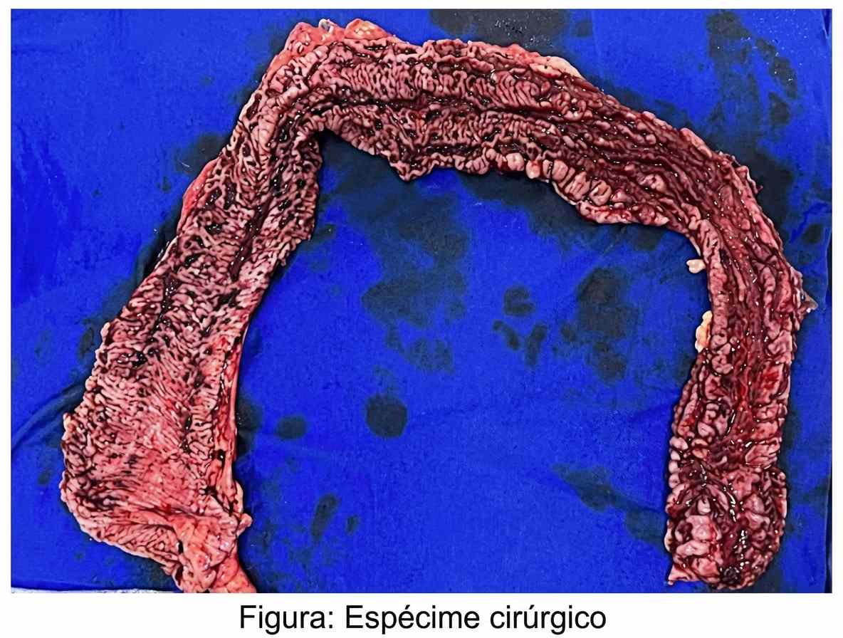 Imagem da questão de Doença Inflamatória Intestinal (DII)