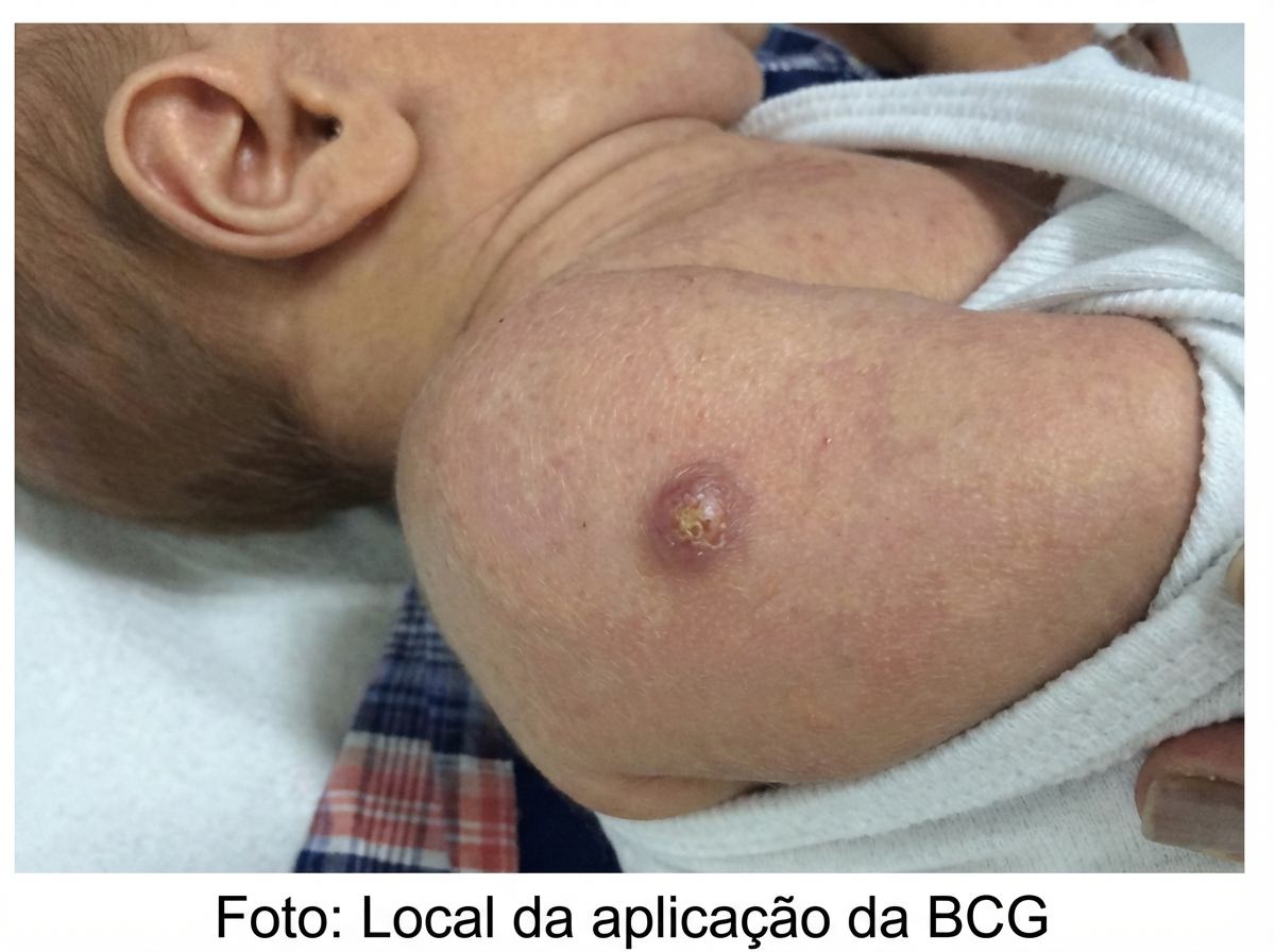 Imagem da questão de Imunizações