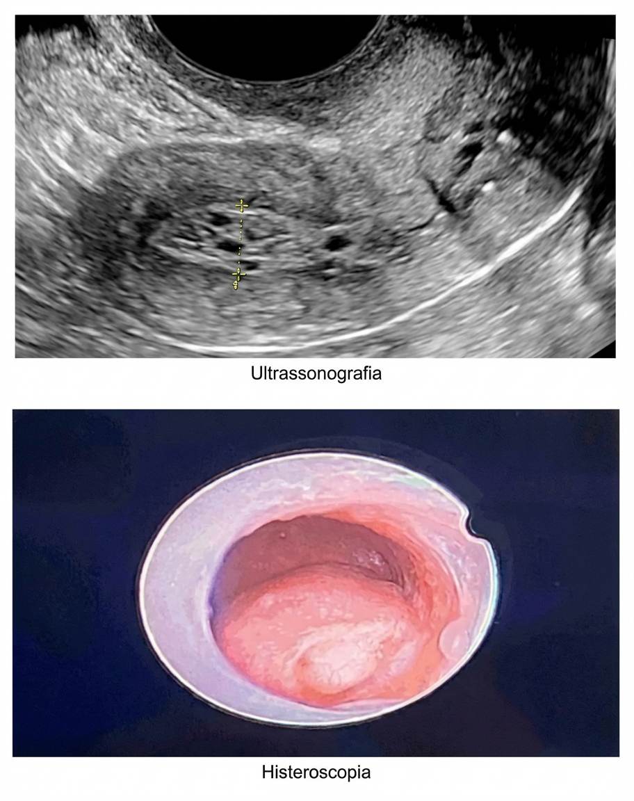Imagem da questão de Climatério e menopausa
