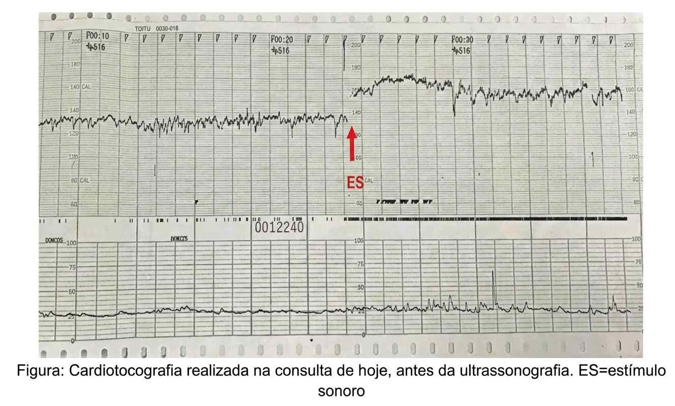 Imagem da questão de Monitorização Fetal