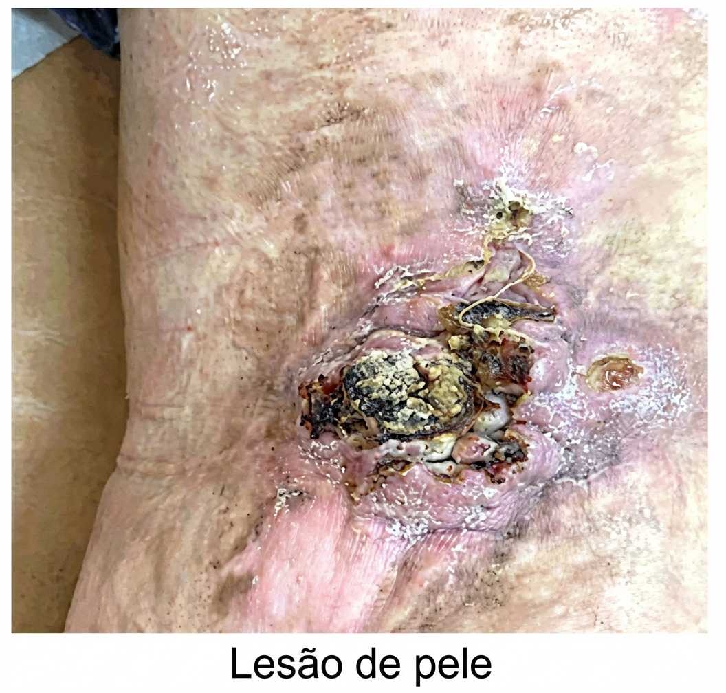Imagem da questão de Queimaduras