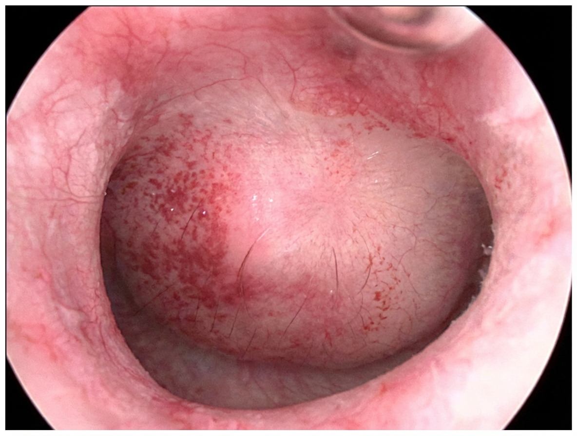 Imagem da questão de Sangramento uterino anormal