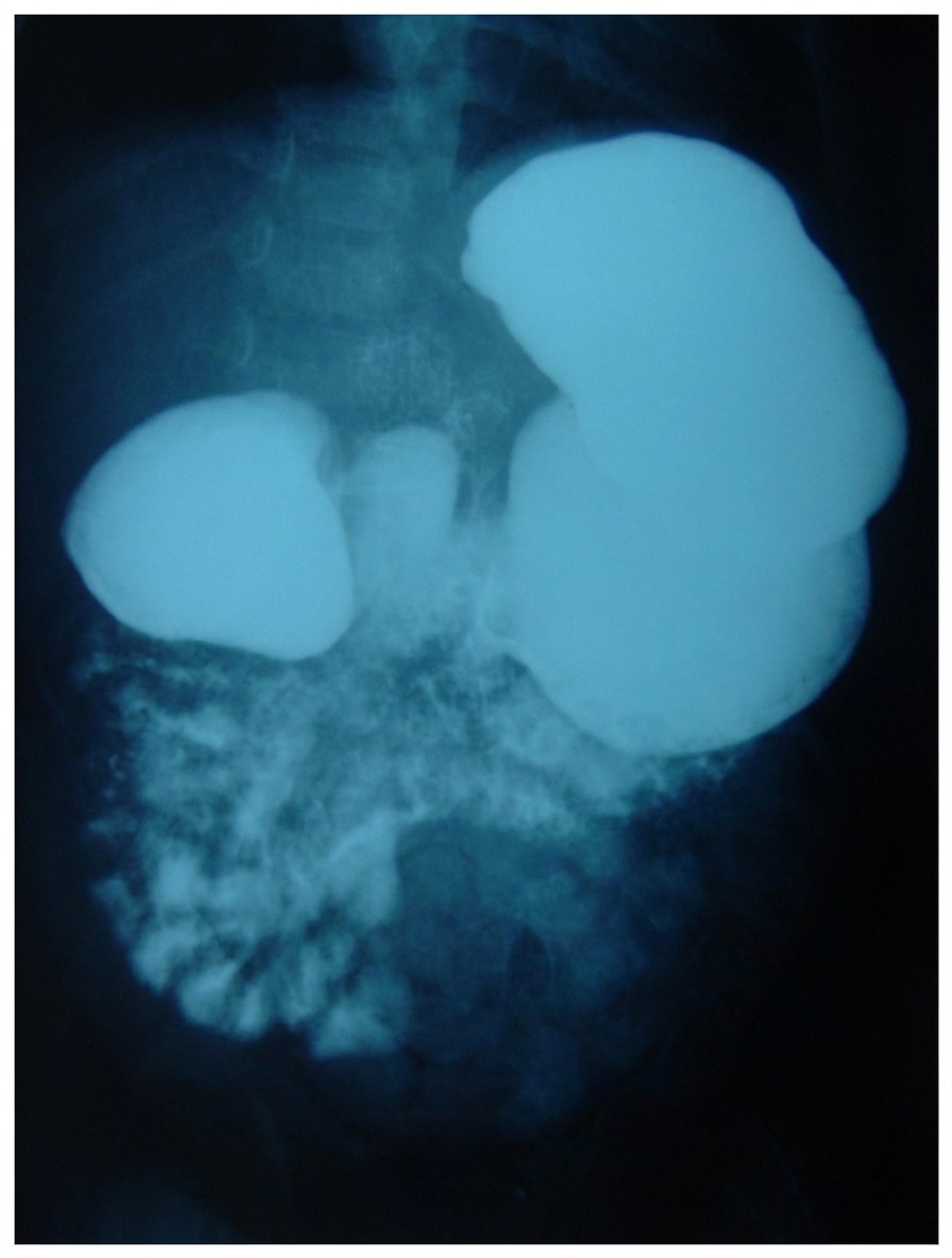 Imagem da questão de Cirurgia Neonatal e Emergências