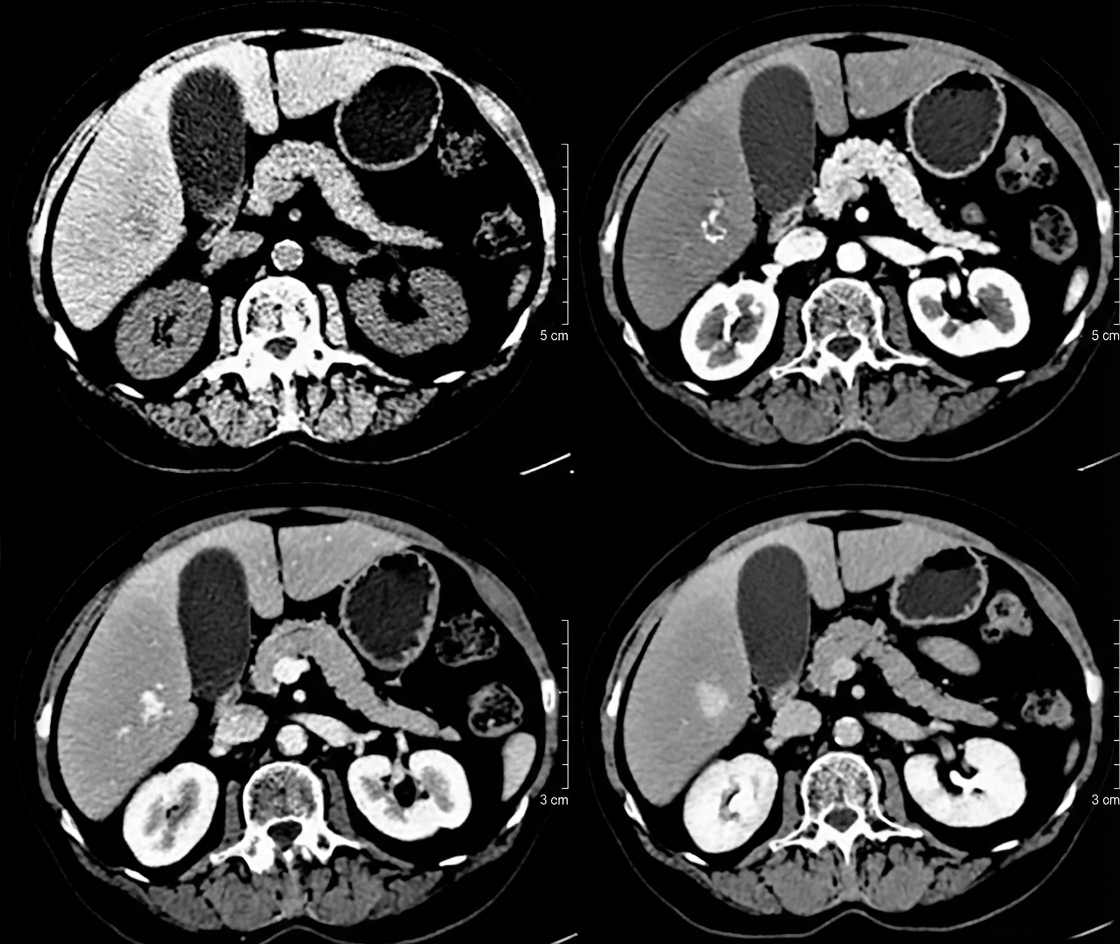 Imagem da questão de Hepatobiliar