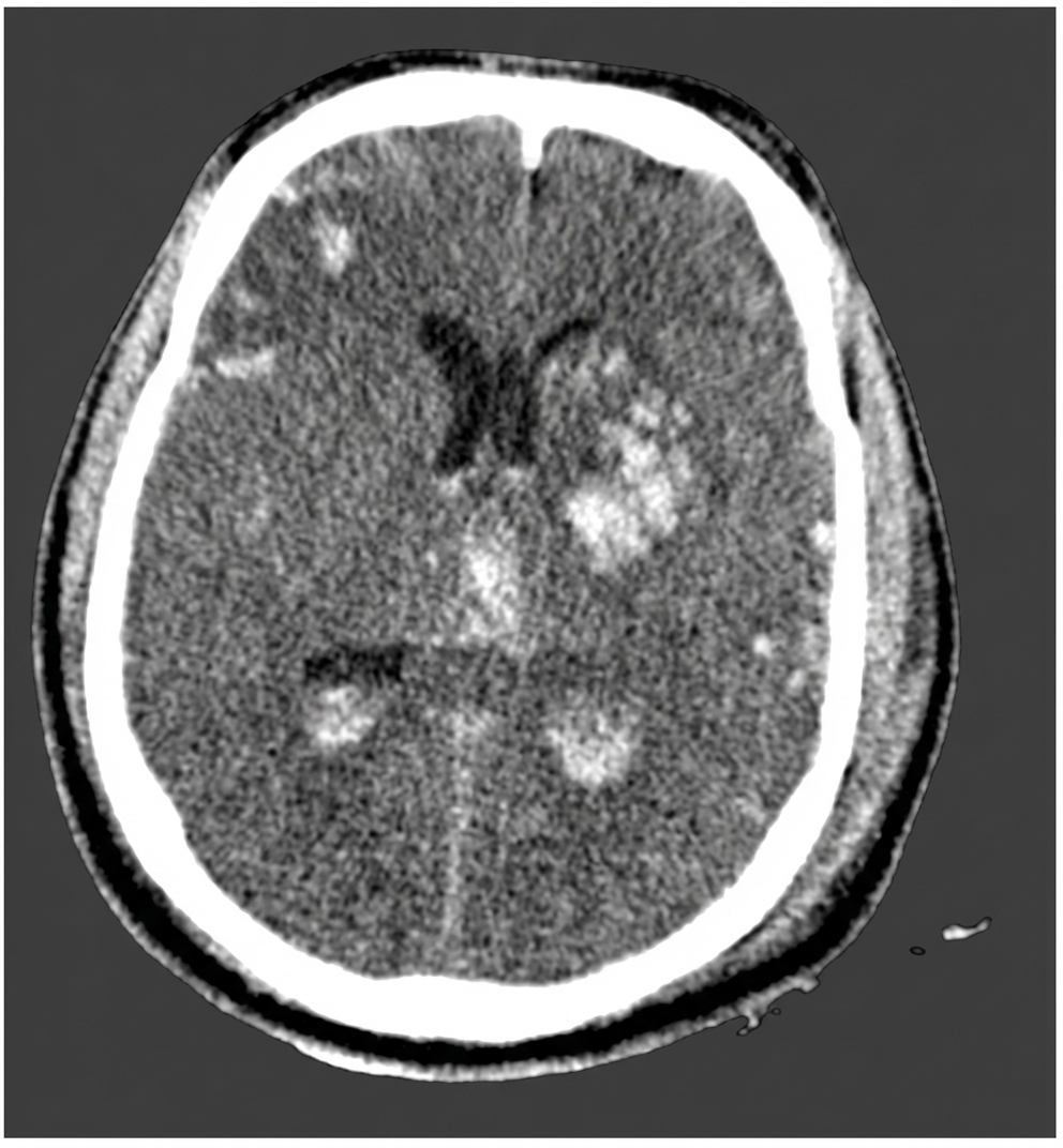 Imagem da questão de Trauma Cranioencefálico (TCE)