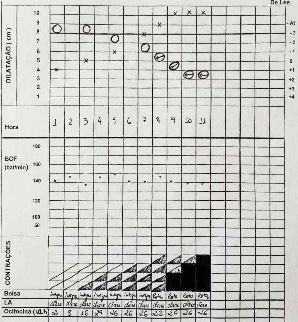 Imagem da questão de Complicações Puerperais