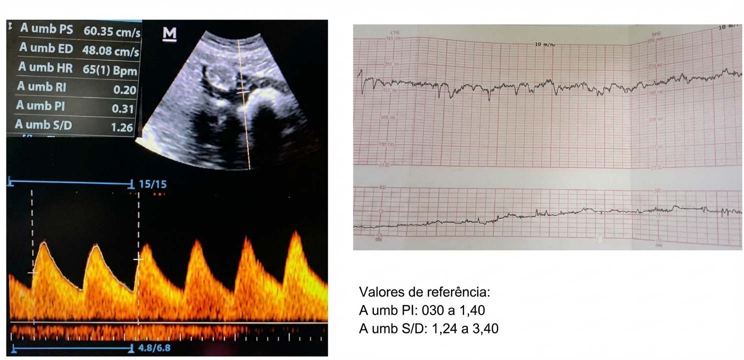 Imagem da questão de Alterações do Crescimento Fetal