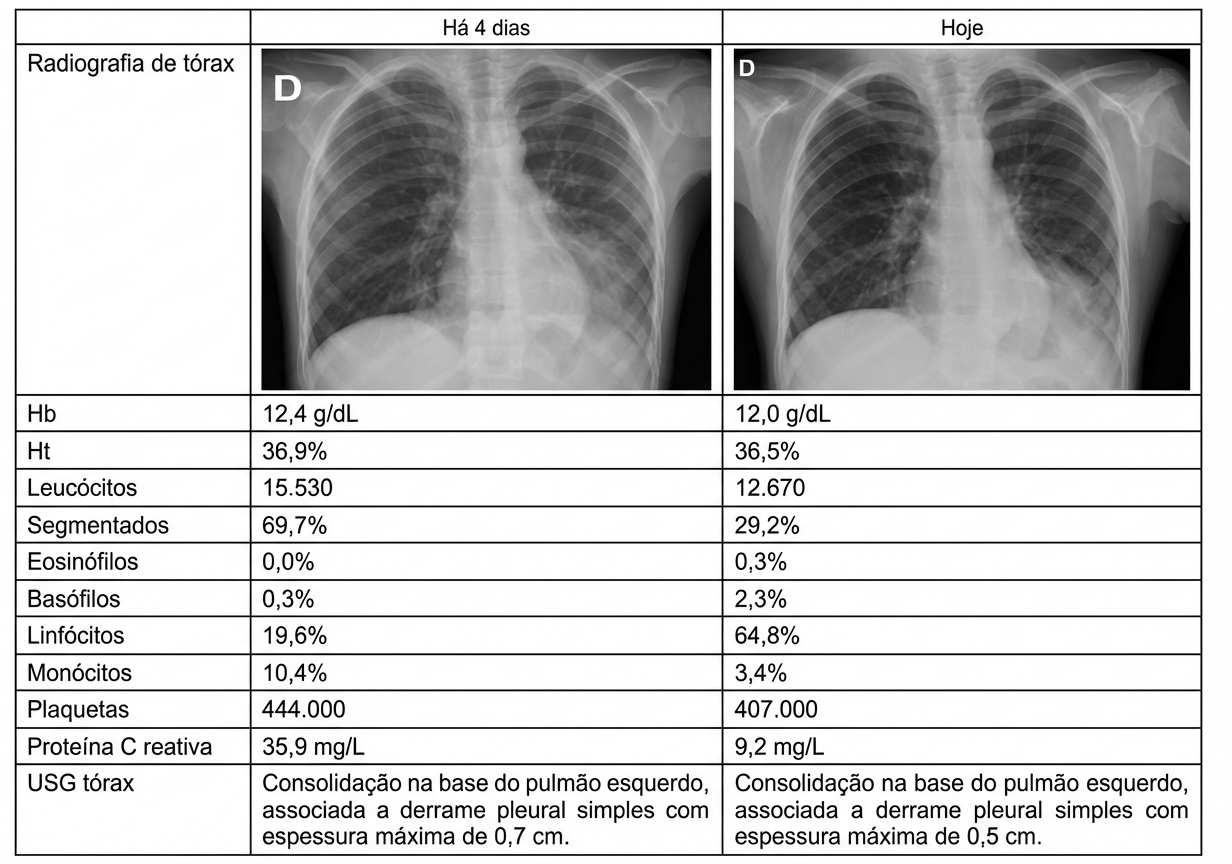Imagem da questão de Infecções Respiratórias Baixas