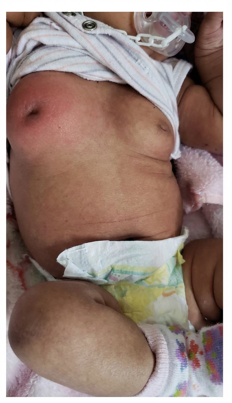 Imagem da questão de Sepse Neonatal
