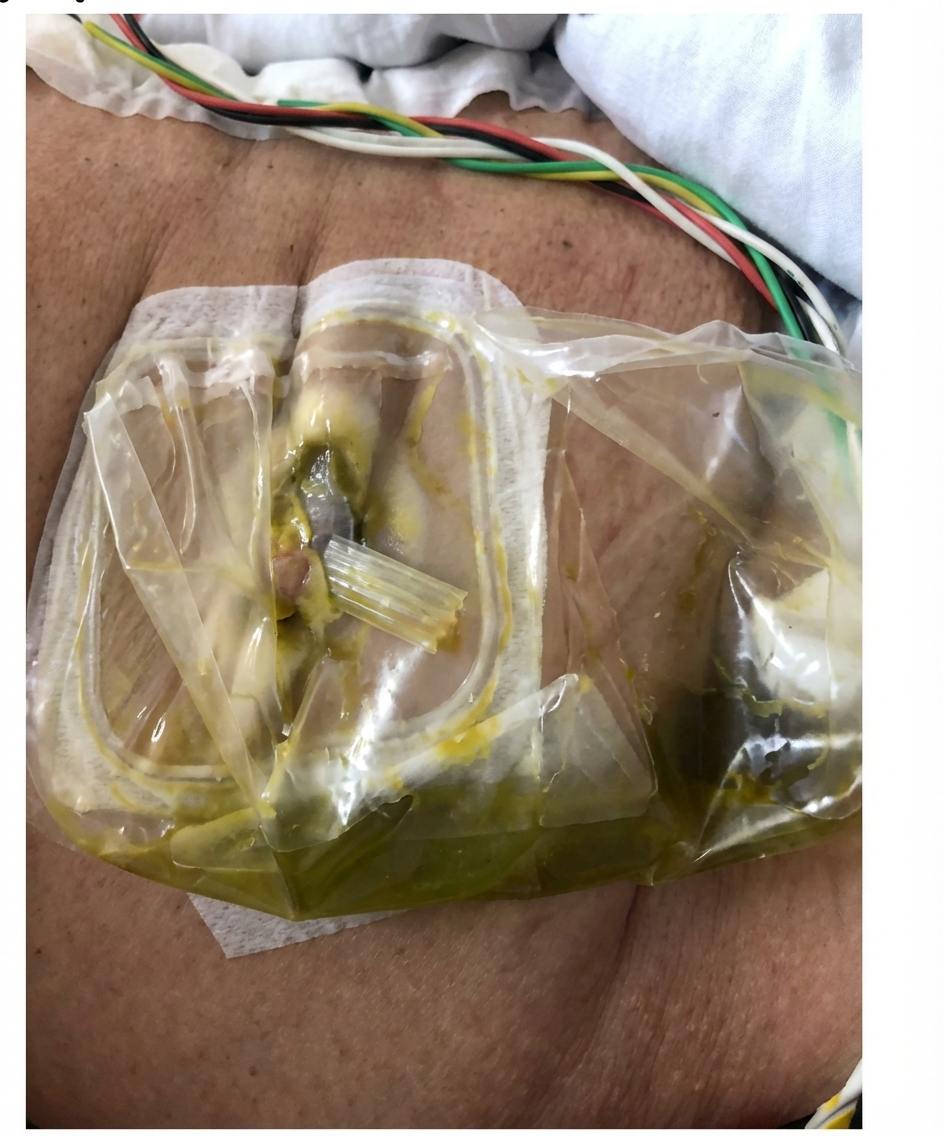 Imagem da questão de Cirurgia Gástrica