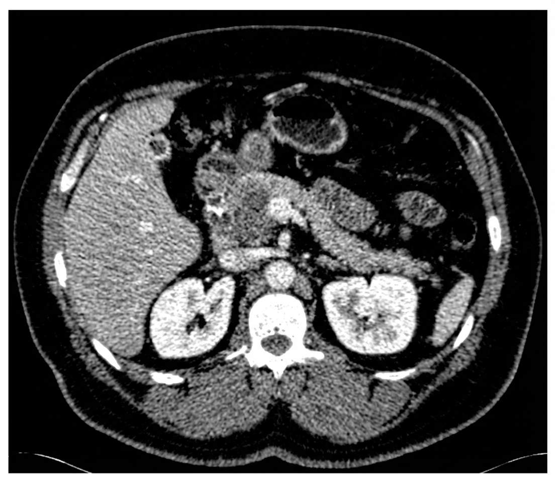 Imagem da questão de Pancreatobiliar