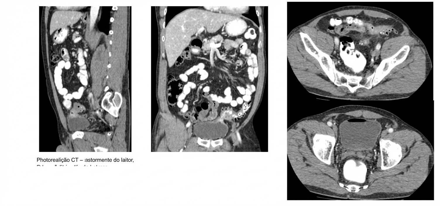 Imagem da questão de Coloproctologia
