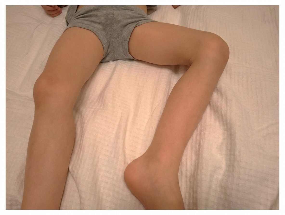 Imagem da questão de Infecções Osteoarticulares