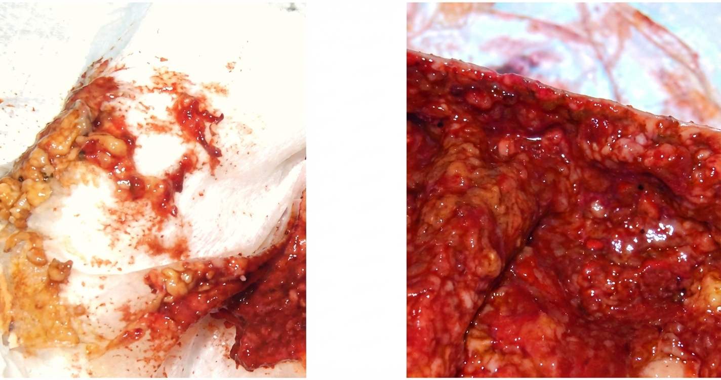 Imagem da questão de Emergências Cirúrgicas na Infância