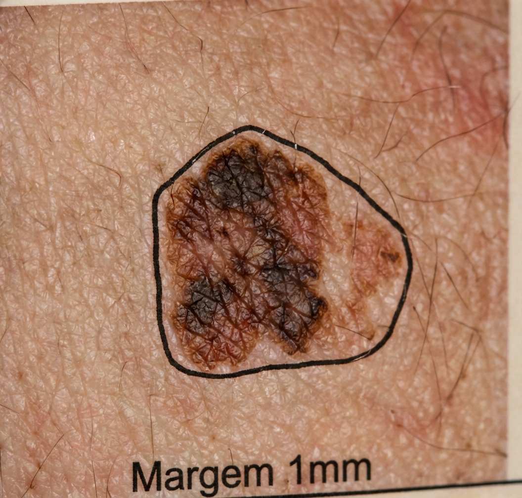 Imagem da alternativa B