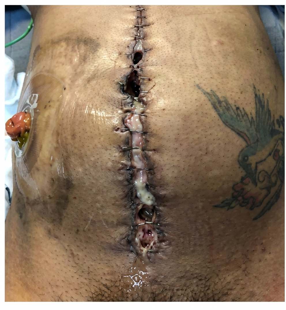Imagem da questão de Avaliacão perioperatória