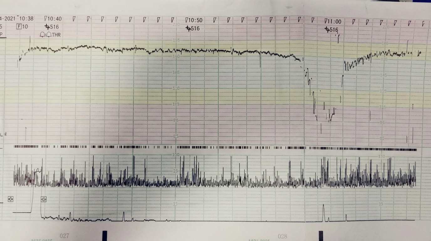 Imagem da questão de Infecções na Gestação
