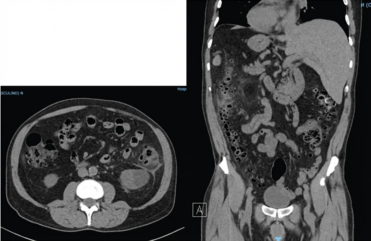 Imagem da questão de Coloproctologia