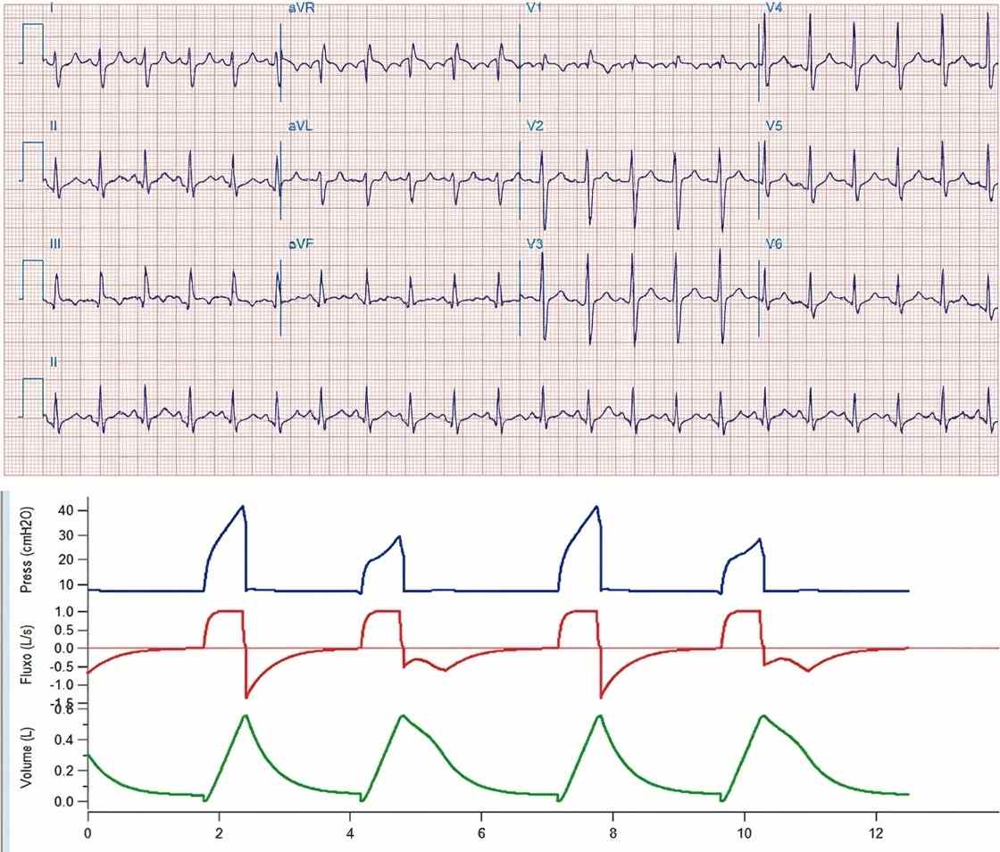 Imagem da questão de Distúrbios Vasculares Pulmonares
