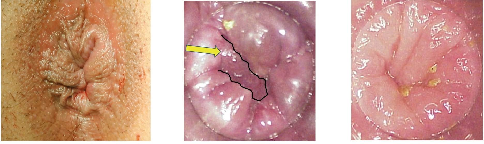 Imagem da questão de Coloproctologia
