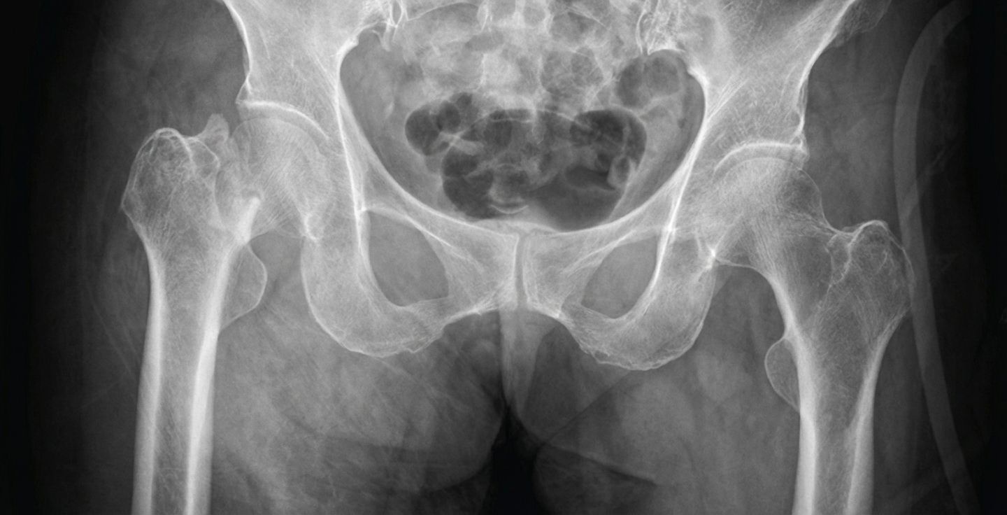 Imagem da questão de Trauma Ortopédico