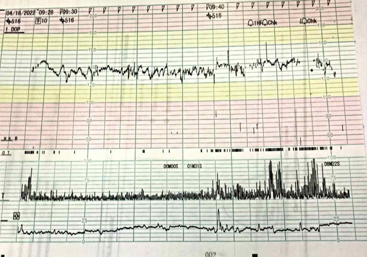 Imagem da questão de Monitorização Fetal