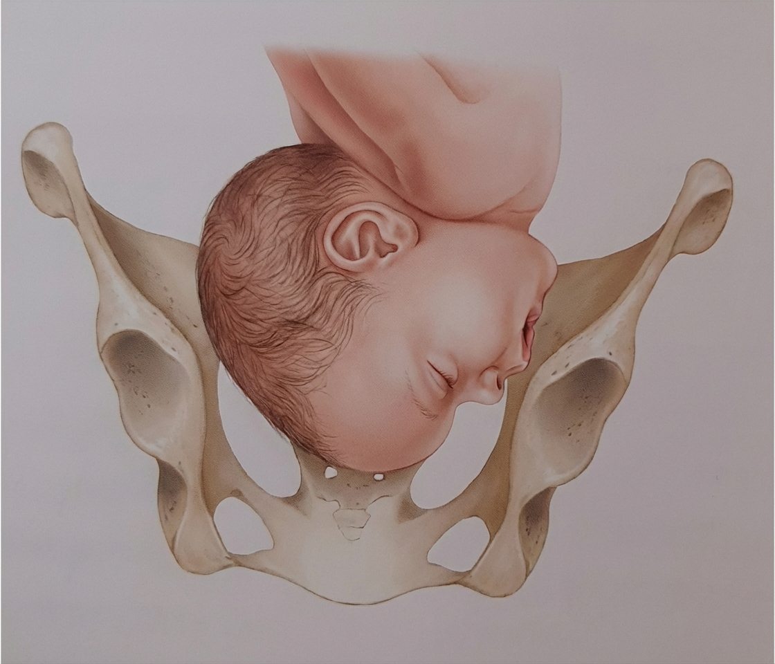 Imagem da questão de Biomecânica do Parto