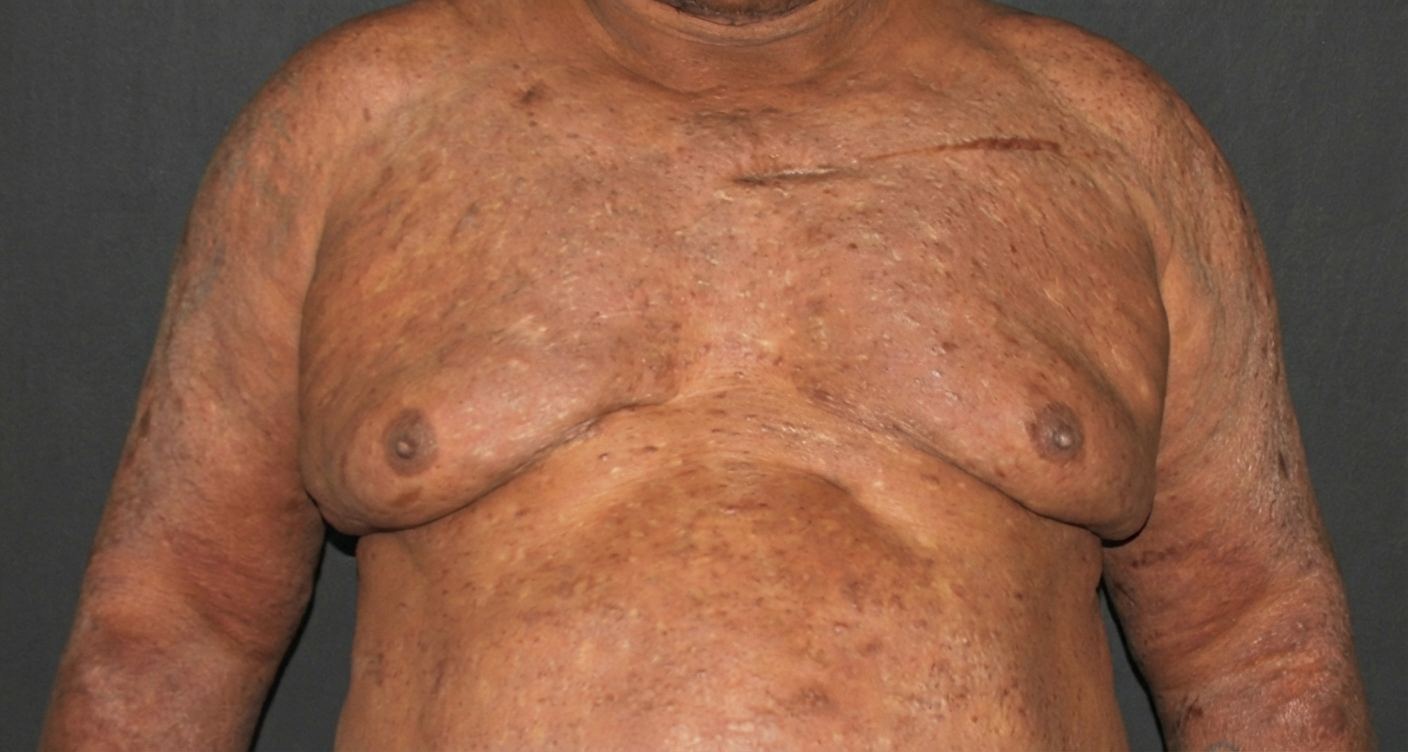 Imagem da questão de Infecções Cutâneas