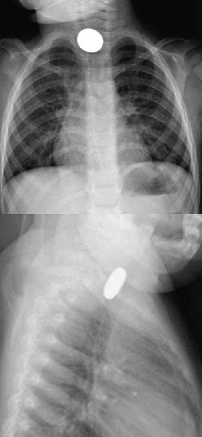 Imagem da questão de Emergências Gastrointestinais