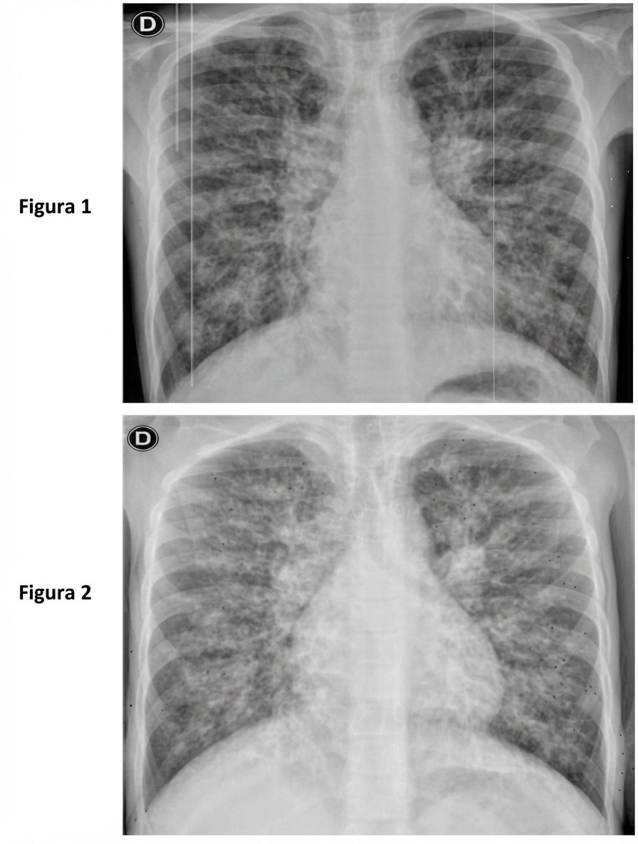 Imagem da questão de Fibrose Cística